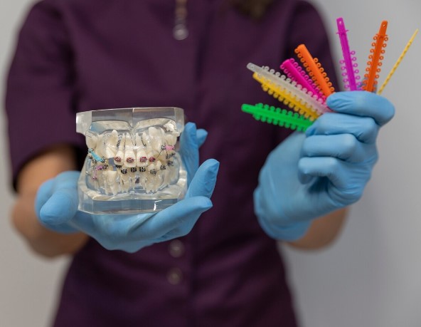 Modèle orthodontique et brossettes interdentaires